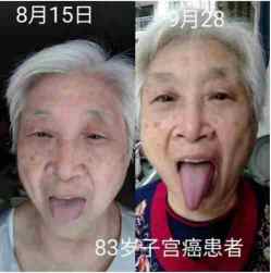 国医名师——张胜林